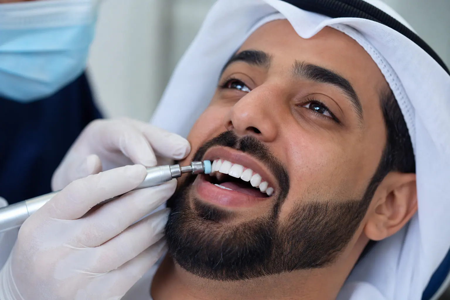 تلميع الأسنان — ابتسامة نظيفة ولامعة بعد التنظيف
